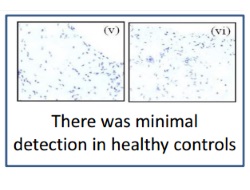 Publication thumbnail: Hypoxia and STAT3 signalling interactions regulate pro-inflammatory pathways in rheumatoid arthritis